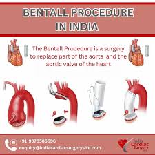 Logo of Cost of Bentall Procedure India Hospitals In Perth, Scotland